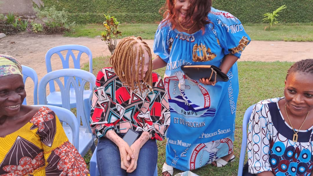 Support for people with albinism 1