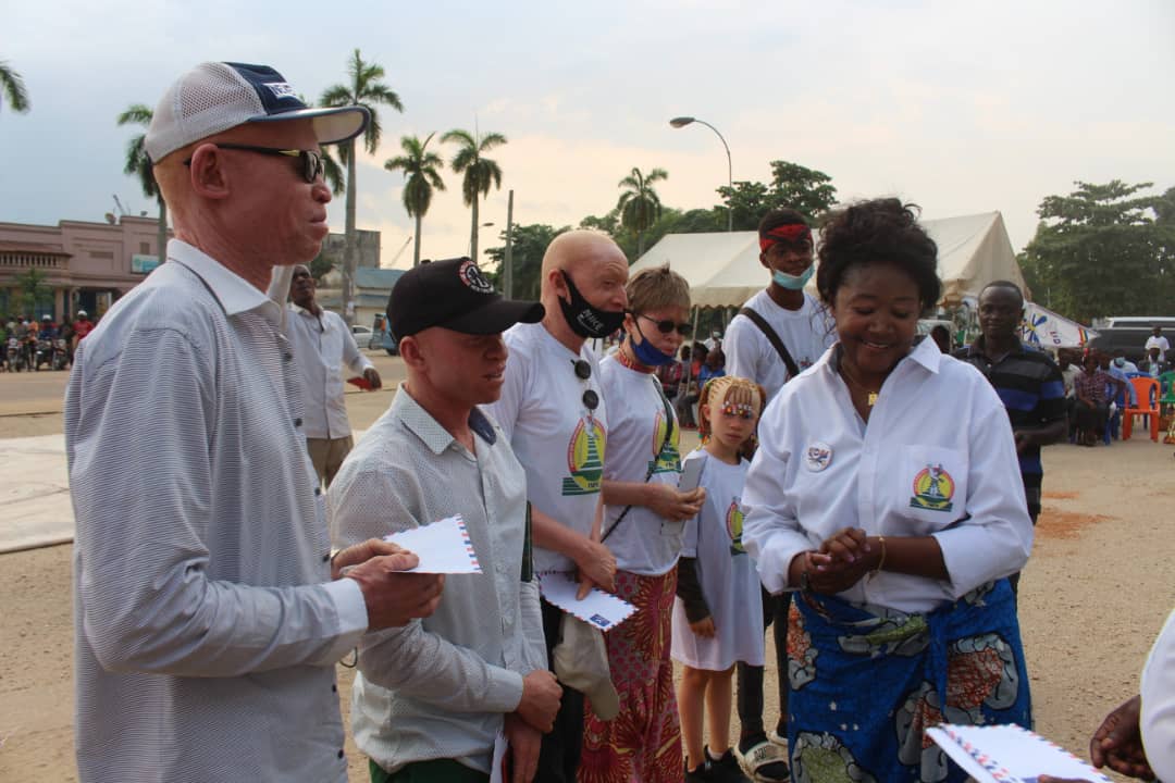 Support for people with albinism 2
